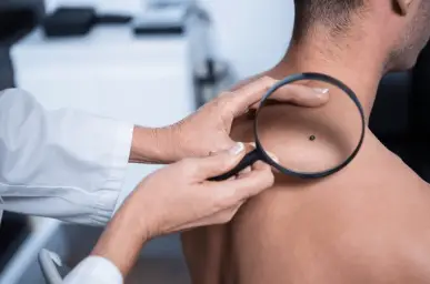 Skin Checks