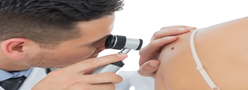 Skin Cancer Check